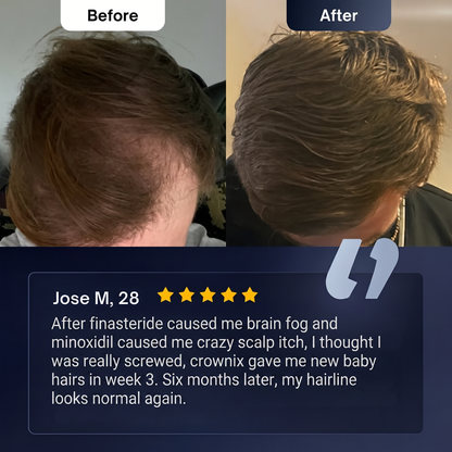Hair Growth Roll-On Serum™