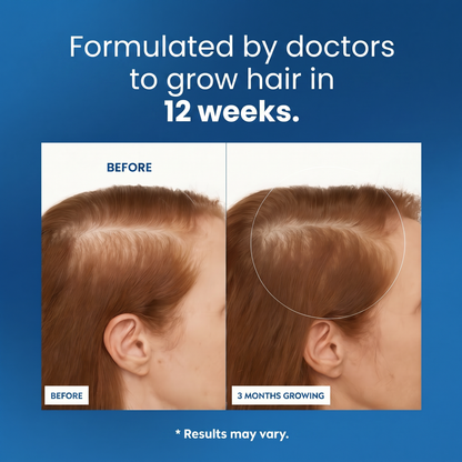 Hair Growth Roll-On Serum™