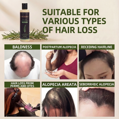 Organic Rosemary Shampoo for Hair Growth